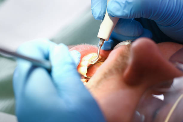Best Weekend Emergency Dental Services in Mount Gay Shamrock, WV